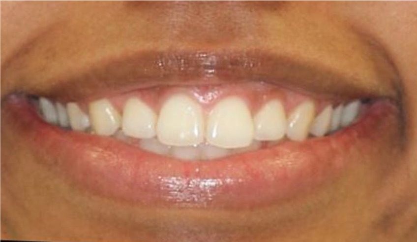 WhatsApp-Image-2022-07-25-at-7.23.31-PM-1