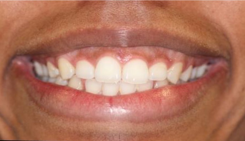 WhatsApp-Image-2022-07-25-at-7.23.31-PM