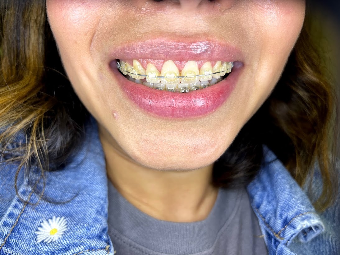 WhatsApp-Image-2022-07-25-at-7.25.40-PM-1