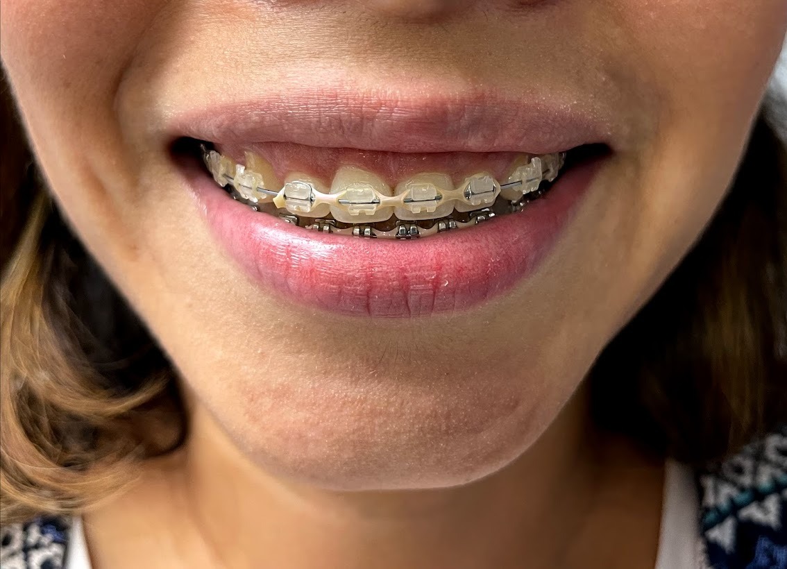 WhatsApp-Image-2022-07-25-at-7.25.40-PM